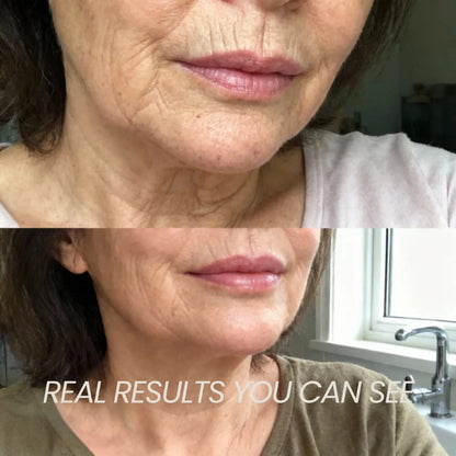 Transform Wrinkles, Fine Lines, And Tired Creases Naturally