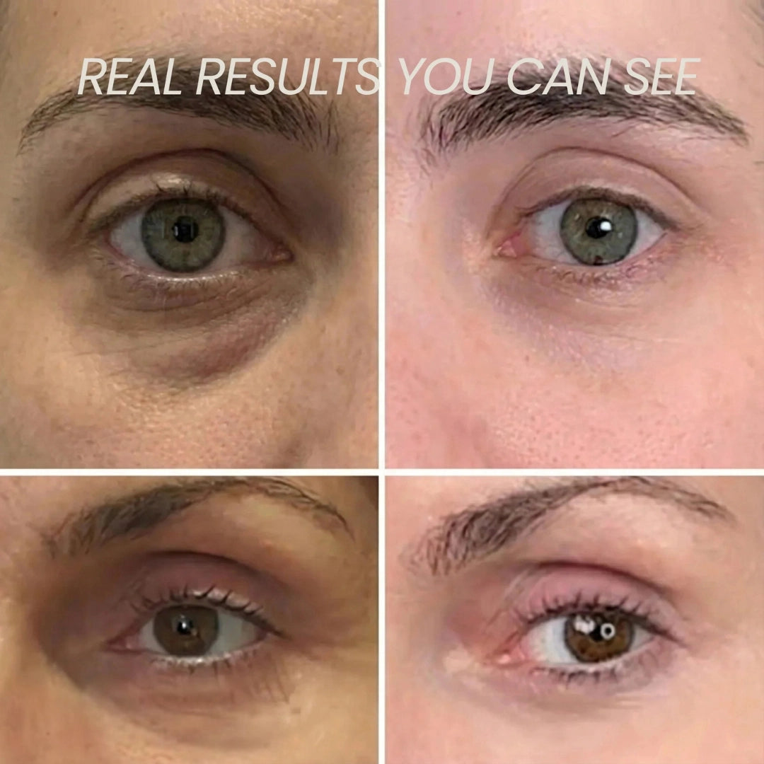 Transform Wrinkles, Fine Lines, And Tired Creases Naturally
