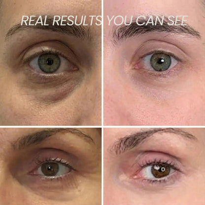 Transform Wrinkles, Fine Lines, And Tired Creases Naturally