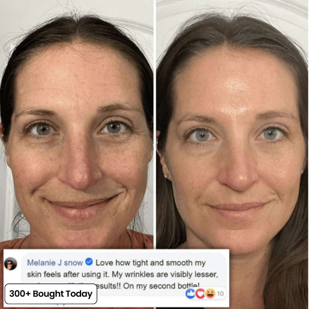 Transform Wrinkles, Fine Lines, And Tired Creases Naturally